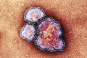 Parents Urged To Check Children's Mmr Vaccine Records Following A Rise In Measles Cases
