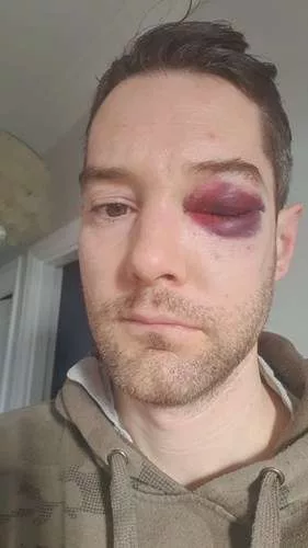 Man Who Caused Severe Injuries To Sussex Police Officer Given Suspended Sentence