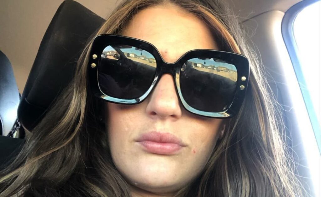 Woman Banned from Owning Dogs After Series of Attacks – UKNIP