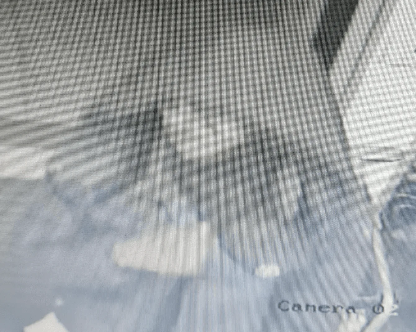 CCTV images released after teenager stabbed in South London – (ID 558020)