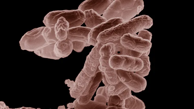 UK on High Alert as E. coli Outbreak Hits 113 Across England, Wales, Scotland, and NI