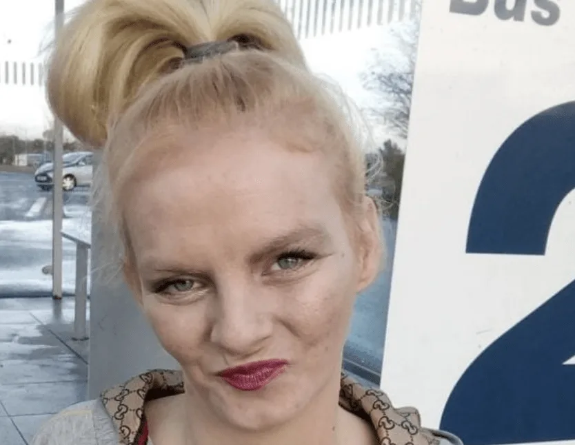 Baby Attacked by Caroline Thomson Left Disabled as Sentence Cut from 9 to 6 Years