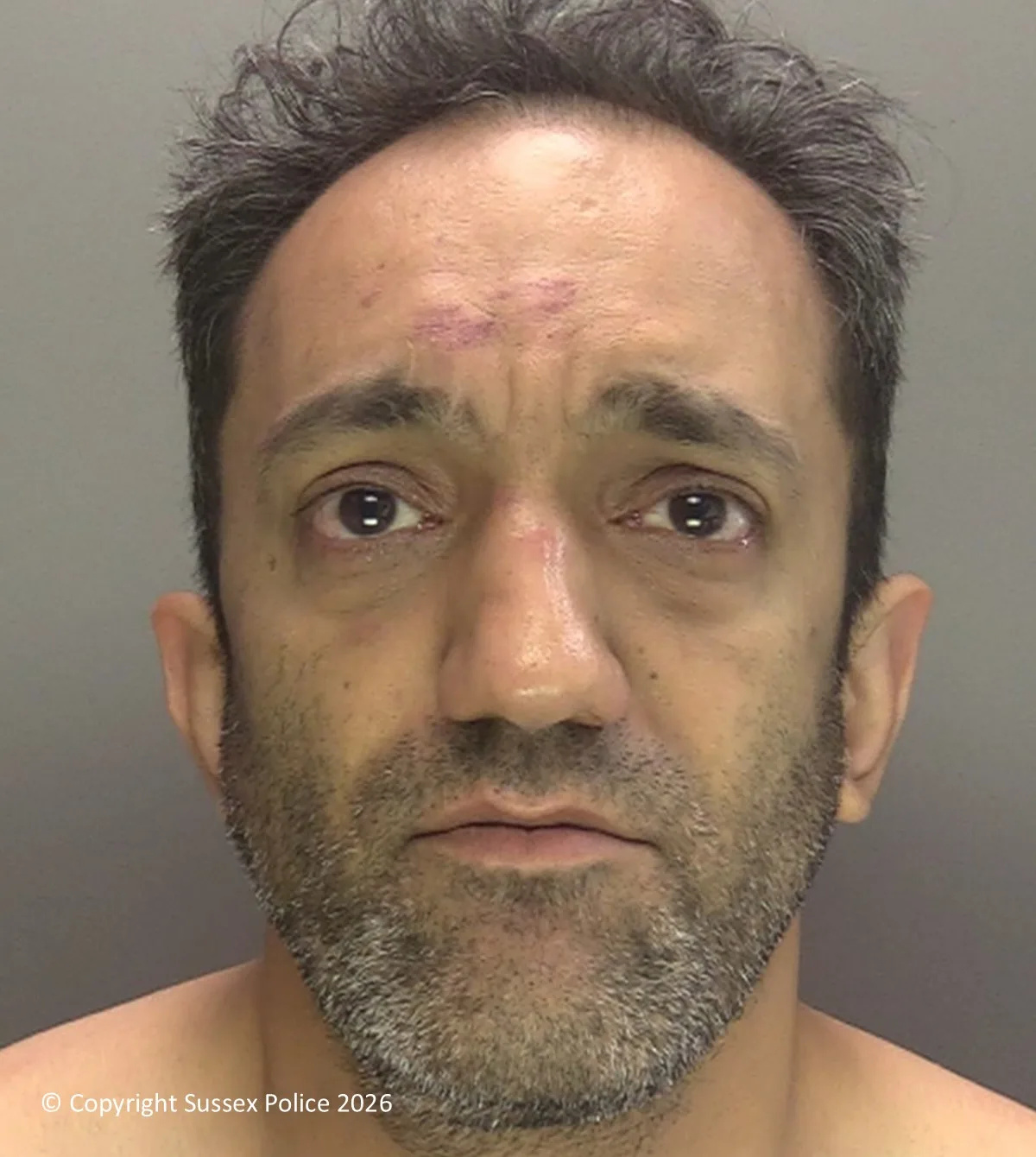 Brutal Crawley Attacker Jailed Nearly 7 Years for Eye-Gouging Police and Racist Road Rage Rampage