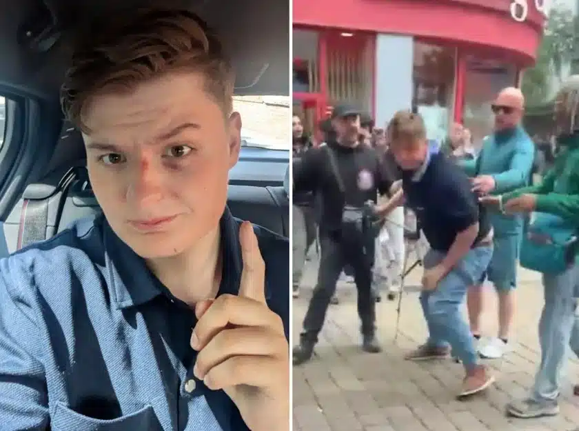 Young Bob Labels Manchester Assault ‘Most High-Profile Case,’ Police Confirm