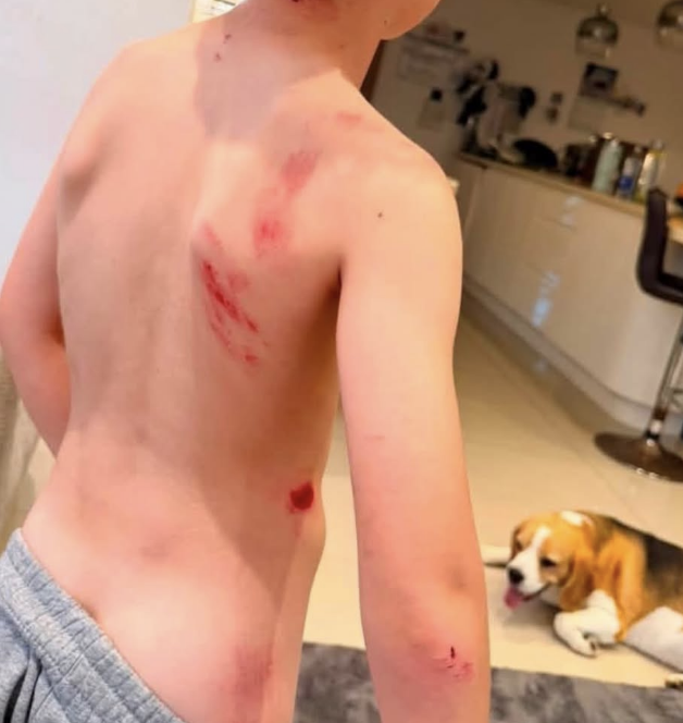 Family Appeal for Witnesses After Child Knocked Down by E-Bike Rider on Seafront