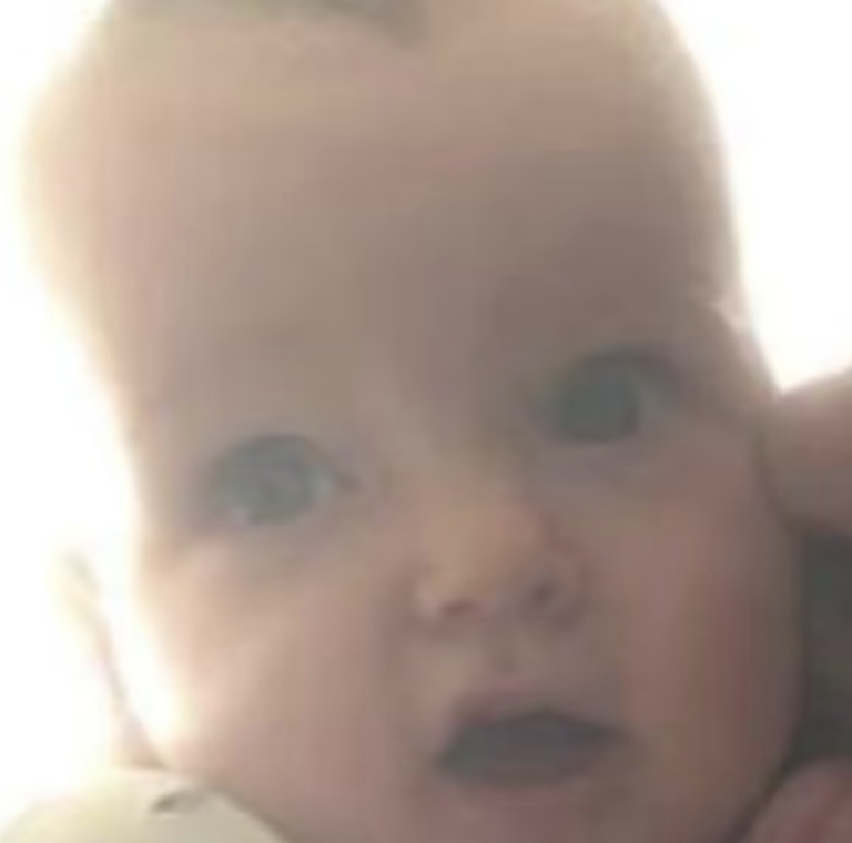Parents deny causing death of one-year-old son who died from severe malnutrition